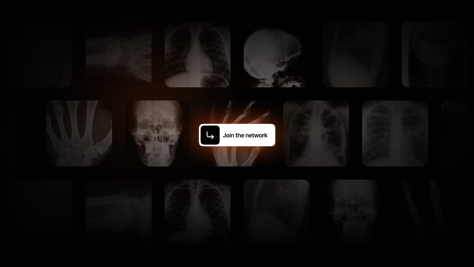 Epsilon Health